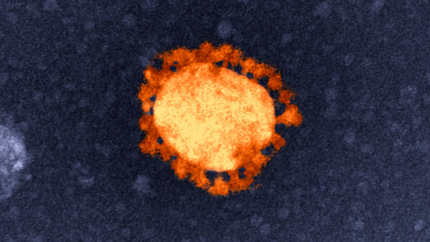  An electron-microscope image of the COVID-19 virus, isolated from the first Australian coronavirus case. Note the bubble in the centre surrounded by spikes.