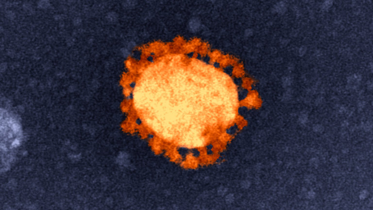 Coronavirus Indonesian Woman Becomes 12th Victorian Covid 19 Case