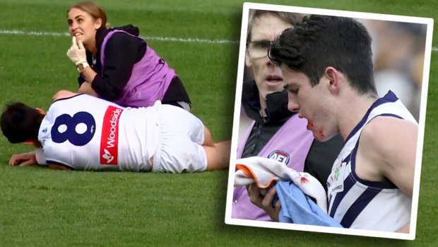 Andrew Brayshaw suffered significant injuries to his mouth.