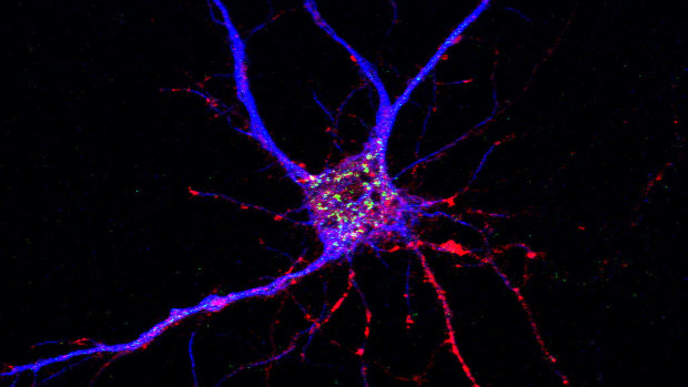 A potential drug target for Alzheimer’s disease has been discovered, affecting both neurons and brain immune cells.