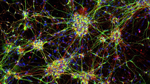 Stem cell-derived neurons from a four-year-old child with a mutation in the SCN2A gene causing epileptic encephalopathy.  