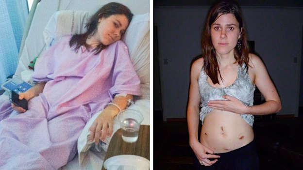 Irena Black in hospital and after her operation. “When they got in there, both the ovary and tube were necrotic because they’d been dead for so long,” she said.