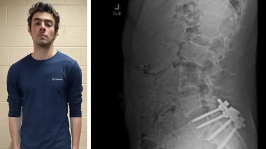 Luigi Mangione and his X-ray.