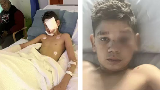Jayden, 13, was mauled by a WA Police dog on Sunday night as officers responded to reports of incidents in St James. 