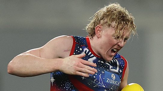 Clayton Oliver reacts after he was kicked in the hand on Thursday night.