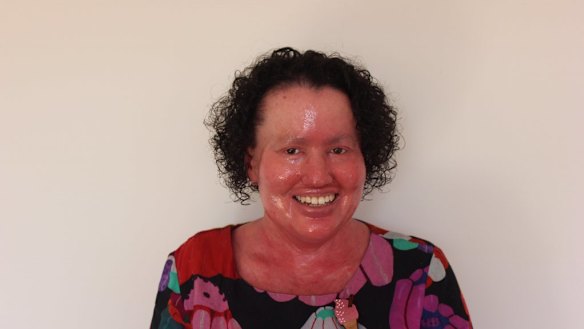 Author and disability advocate Carly Findlay said McGuire's comments were harmful.