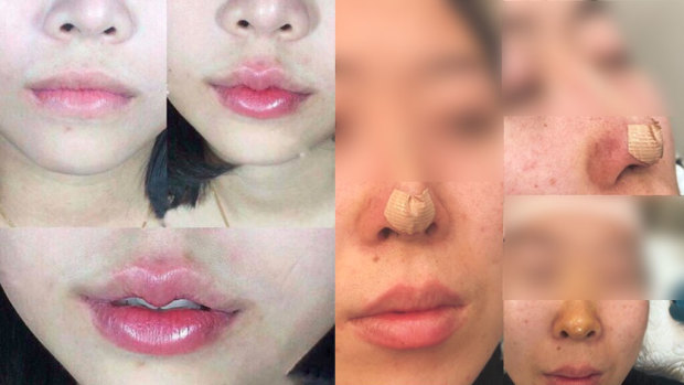 Images of cosmetic procedures posted to an operator's Facebook page.