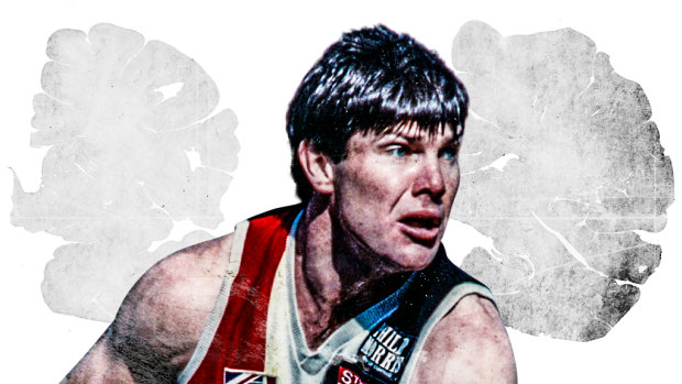Danny Frawley died in late 2019, and it was revealed this week his brain showed signs of chronic traumatic encephalopathy (CTE)