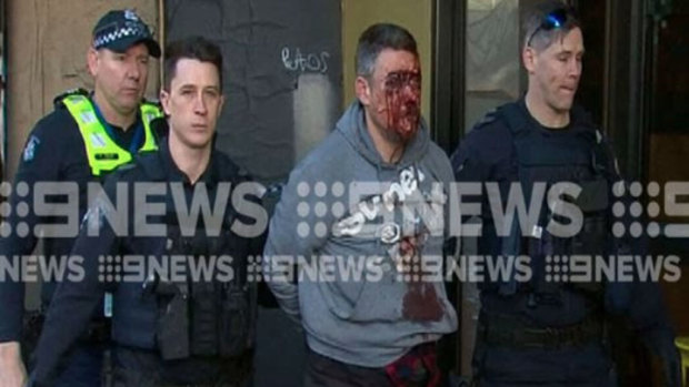 Jonathan Dick, with his face covered in blood, as he was arrested in Melbourne's CBD on Monday morning.