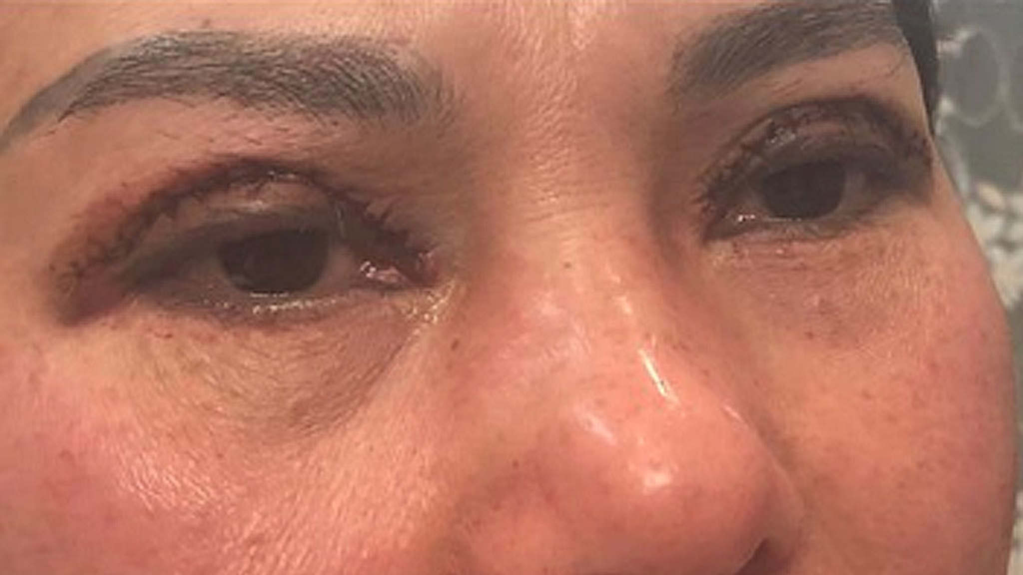 非法整容诊所用低价瞄准华人女客，致澳洲医生频接烂摊子！失败案例触目惊心（组图） - 3