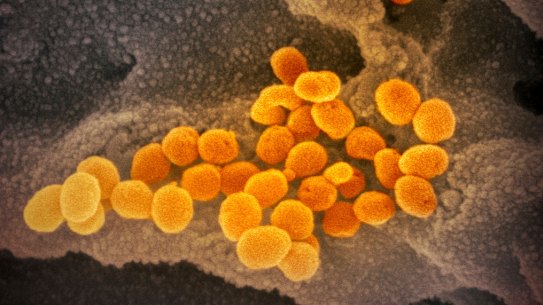 A microscope image shows the Novel Coronavirus SARS-CoV-2, orange, in February 2020 emerging from the surface of cells, gray, cultured in the lab. 