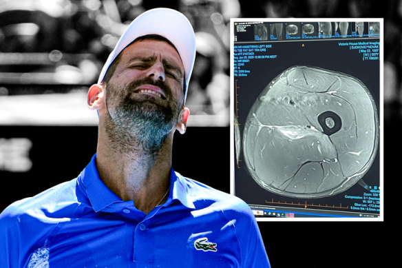 Novak Djokovic and a scan of the injury that forced him to retire from his Australian Open semi-final.