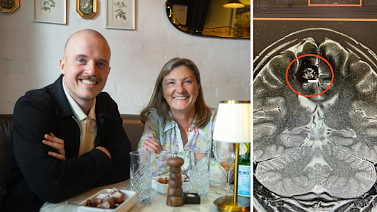 Angus Thomson with his surgeon Kate Drummond plus a scan of his brain.