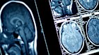 Perth Radiological Clinic sold a minority stake to Allegro in late 2019.
