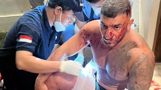 Sanar Ghanim, 34, after being shot in Bali on Saturday night.