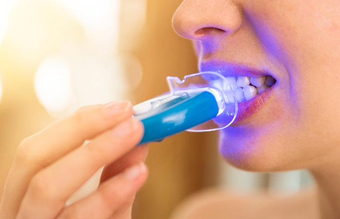 Dentists Warn Against Teens Using At Home Teeth Whitening Kits