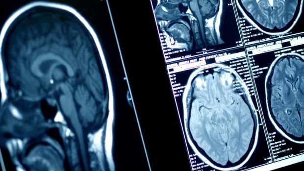 Canberra Hospital's medical imaging department has come under increased budget pressure