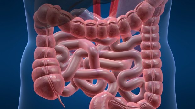QIMR Berhofer research has identified a clear cause, and possible cure, for Crohn's.