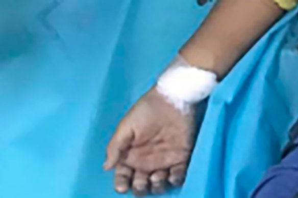 Seven-year-old Ma Khin Myo Chit, whose hand is pictured above, was killed at her home in Mandalay, Myanmar. 