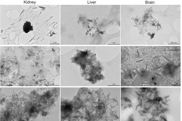 Shards of microplastic captured in kidney, liver and brain samples.