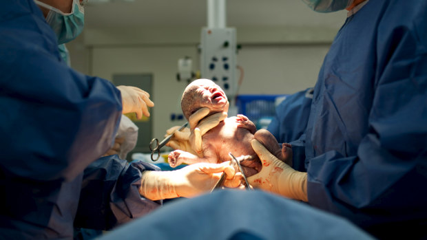 A hospital in Brazil is catering for the demand arising from families' busy schedules and desire to be together at the birth.