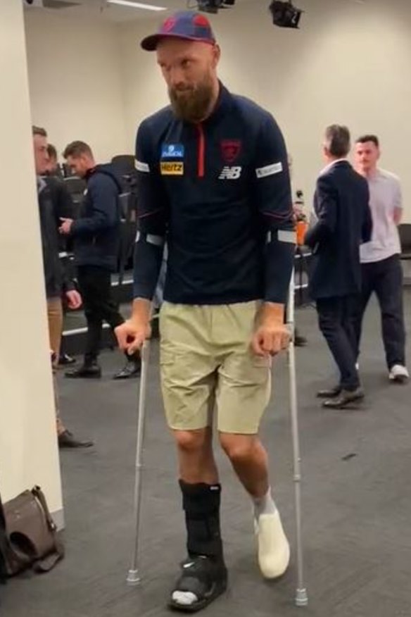 Max Gawn on crutches on Tuesday.