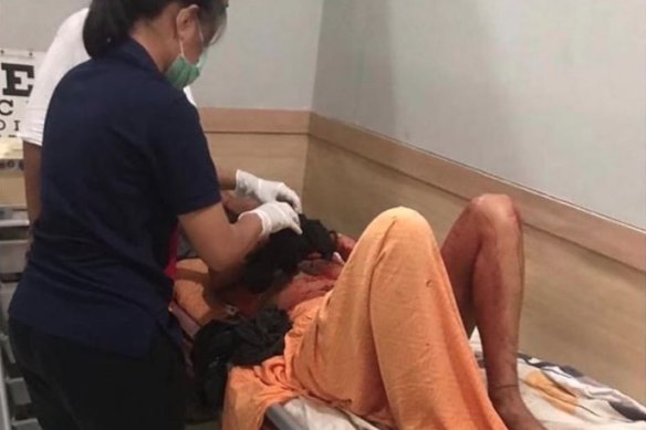 A Spanish-Australian woman is treated after being attacked by a machete-wielding thief near a Bali beach.