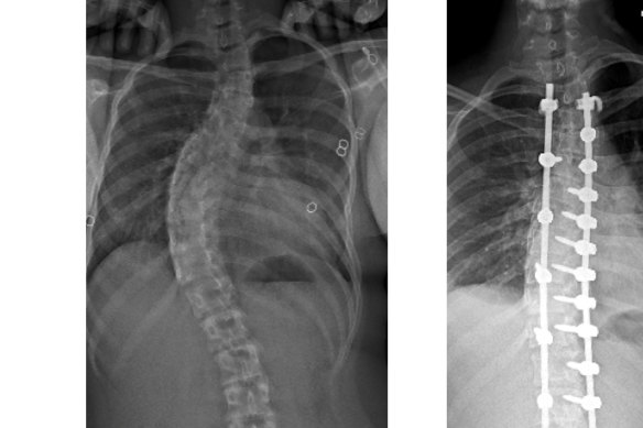 Patient scans of Ella Venville.