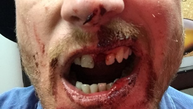 Steven Booth's bloodied and battered face after the attack.