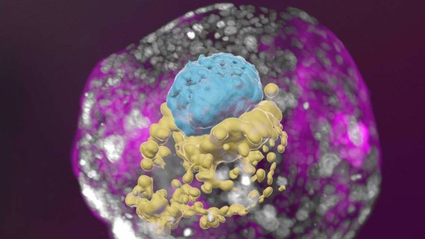 A stem cell–derived human embryo model at a developmental stage equivalent to that of a day 14 embryo. The model has all the compartments that define this stage: the yolk sac (yellow) and the part that will become the embryo itself, topped by the amnion (blue) – all enveloped by cells that will become the placenta (pink). 