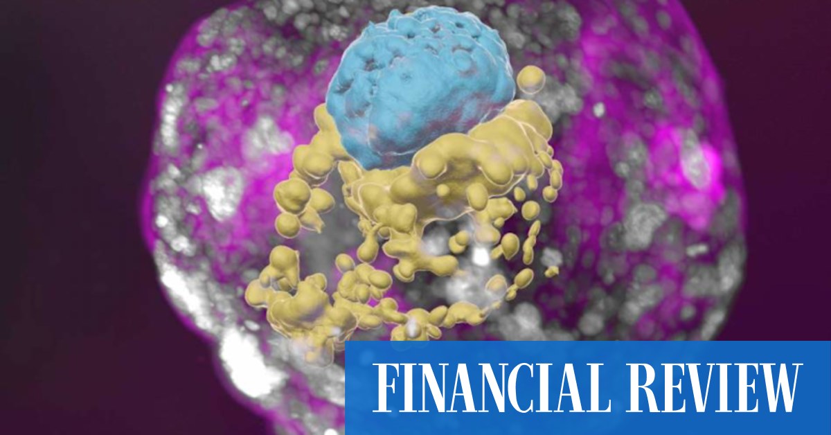 How these tiny 'embryoids' could improve IVF outcomes - Vimarsana News
