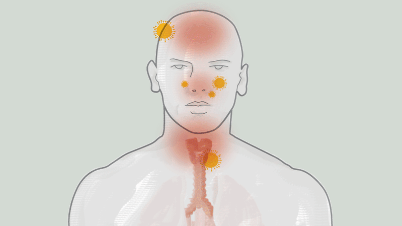 Coronavirus What Does Covid 19 Do To Humans And What Is It Like To Have The Illness