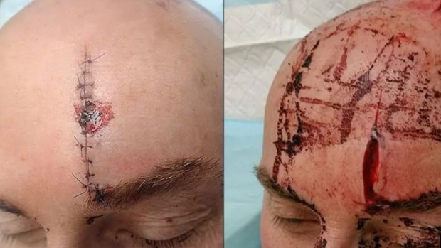Police officer Andrew Swift lost a litre of blood and received 25 stitches to his head after being attacked with a samurai sword.