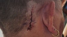 Anne* is fed up. The nurse, with more than 30 years of experience, says she’s been bitten, kicked, pushed and slapped many times over her career. However, the day a geriatric patient with dementia attacked her changed everything.
