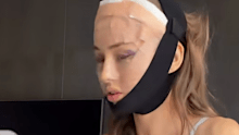 Ruby was forced to head into an Apple Store to get her phone fixed, because the FaceID wouldn’t recognise her post-surgery. 