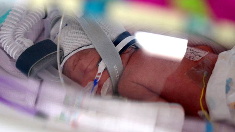 ‘One in 15 million’: Mum gives birth to identical quadruplets in likely Australian first