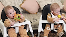 Identical twins Arthur (Artie), left, and Jack, hear for the first time after cochlear implants are switched on.