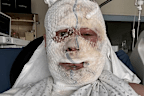 A Sydney man had discussed separating with his partner just hours before he allegedly scalded him with boiling water and beat him with a saucepan at a luxury French chateau.