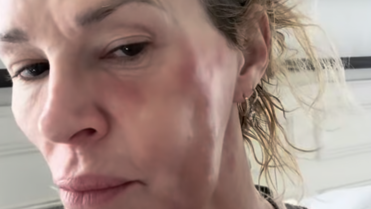 ‘Embarrassed’ reality star’s tears as she crowdfunds money amid health battles
