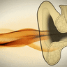 ‘I didn’t catch that’: The trouble with hearing