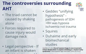 The slide from one of Dr Tully’s presentations about the “controversies” of abusive head trauma / shaken baby syndrome.