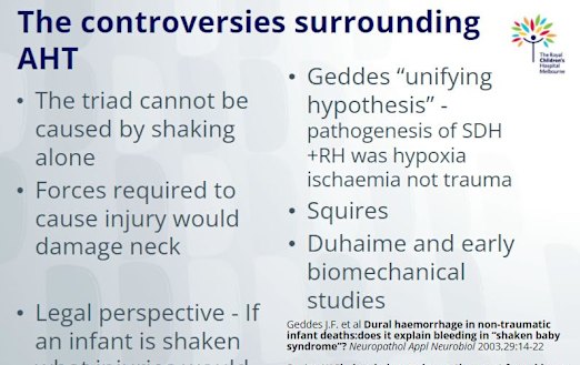 The slide from one of Dr Tully’s presentations about the “controversies” of abusive head trauma / shaken baby syndrome.