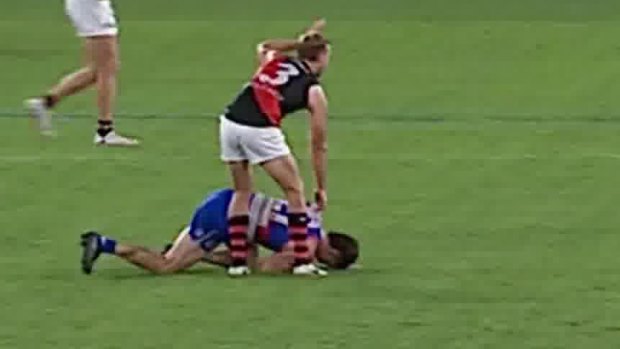 Essendon’s Darcy Parish signals for assistance after Tom Liberatore collapsed.