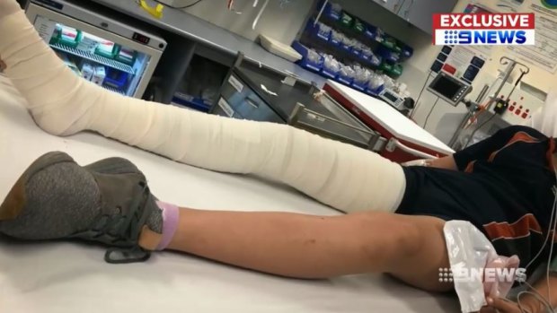 The schoolgirl spent a day in hospital following the bite. 