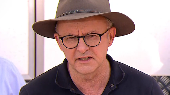 Prime Minister Anthony Albanese has kept the door open to legislating a Voice to Parliament should the referendum fail.