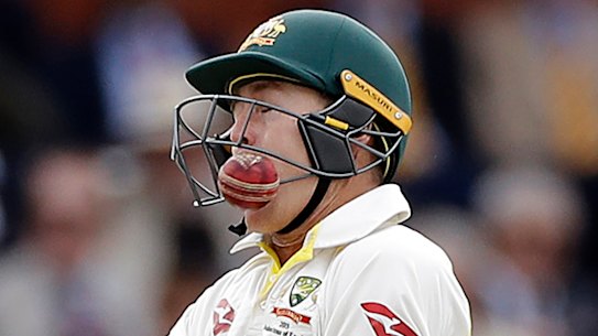 Marnus Lubuschagne gets hit in the grill by Jofra Archer.