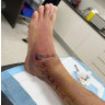 Glenn Maxwell’s wife was told to prepare for the possibility he could lose his foot. 