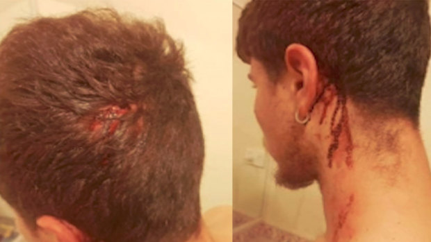 Chef Daniel Maetzing was left bleeding after the attack.