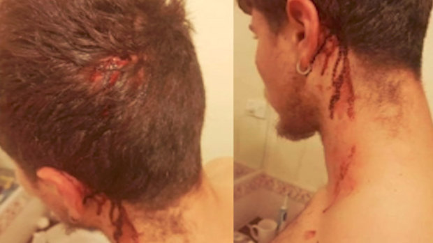 Chef Daniel Maetzing was grazed and bleeding after the attack.