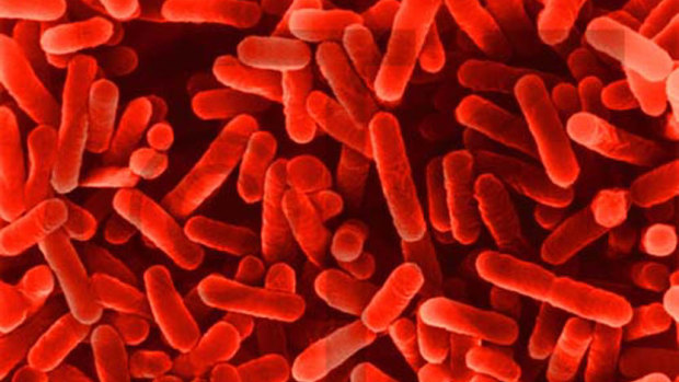 All five cases contracted the infection from breathing in Legionella pneumophila bacteria.